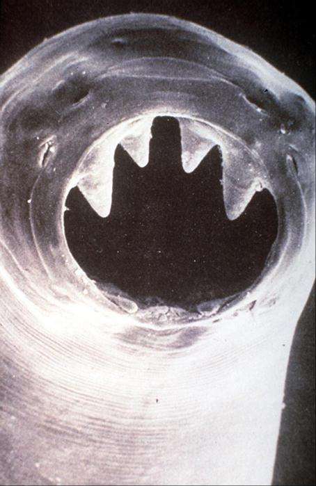 Hookworm Teeth